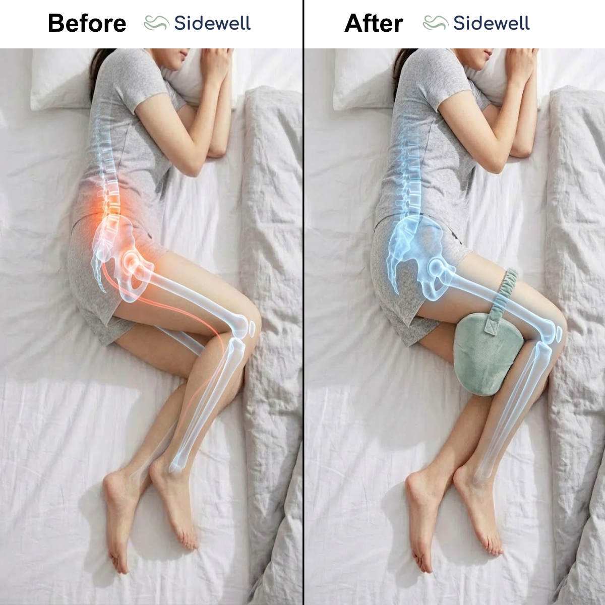 Before and after: a side sleeper's hips and lower back twisted without a pillow, and aligned with the Sidewell knee pillow between her knees